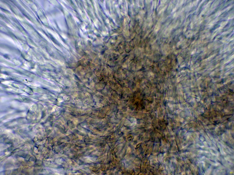 Chlorencoelia versiformis 10 - Excípulo medular Melzer-001